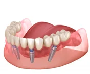 На нижней челюсти